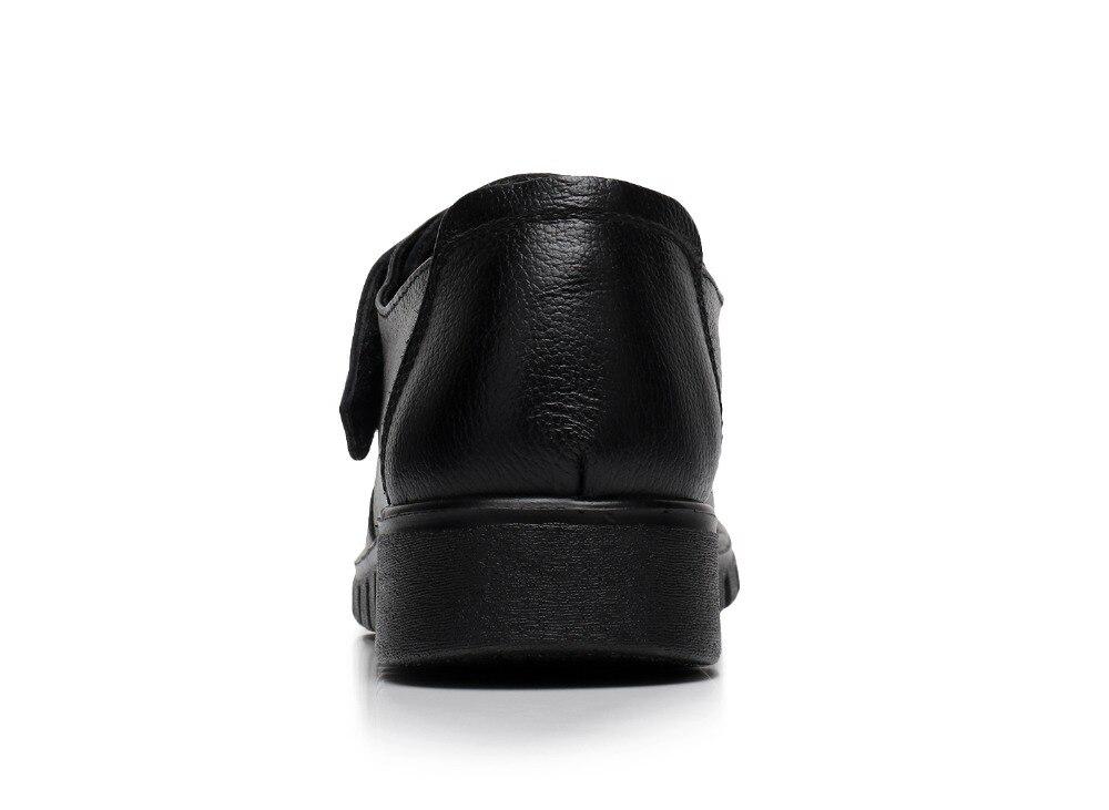 Chaussures orthopédiques hallux valgus.