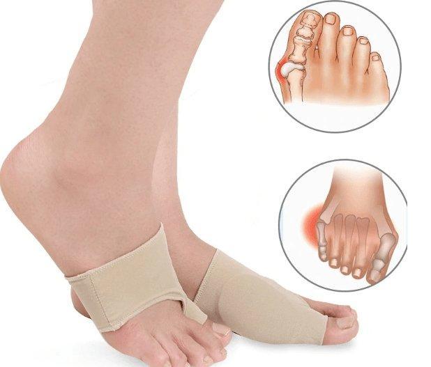 Manchon orthopédique pour oignons.