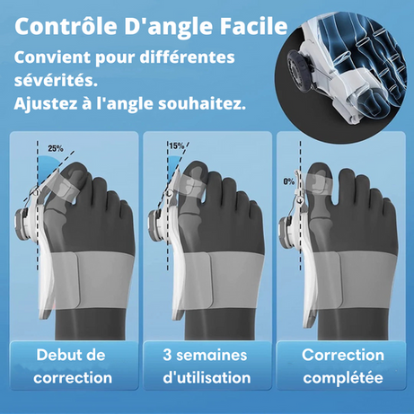 Correcteur Hallux valgus, Correcteur d'oignon