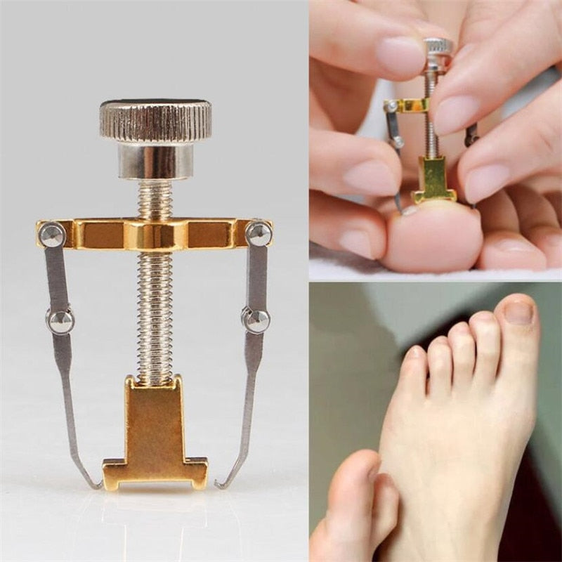 Correcteur d'ongles incarnés.