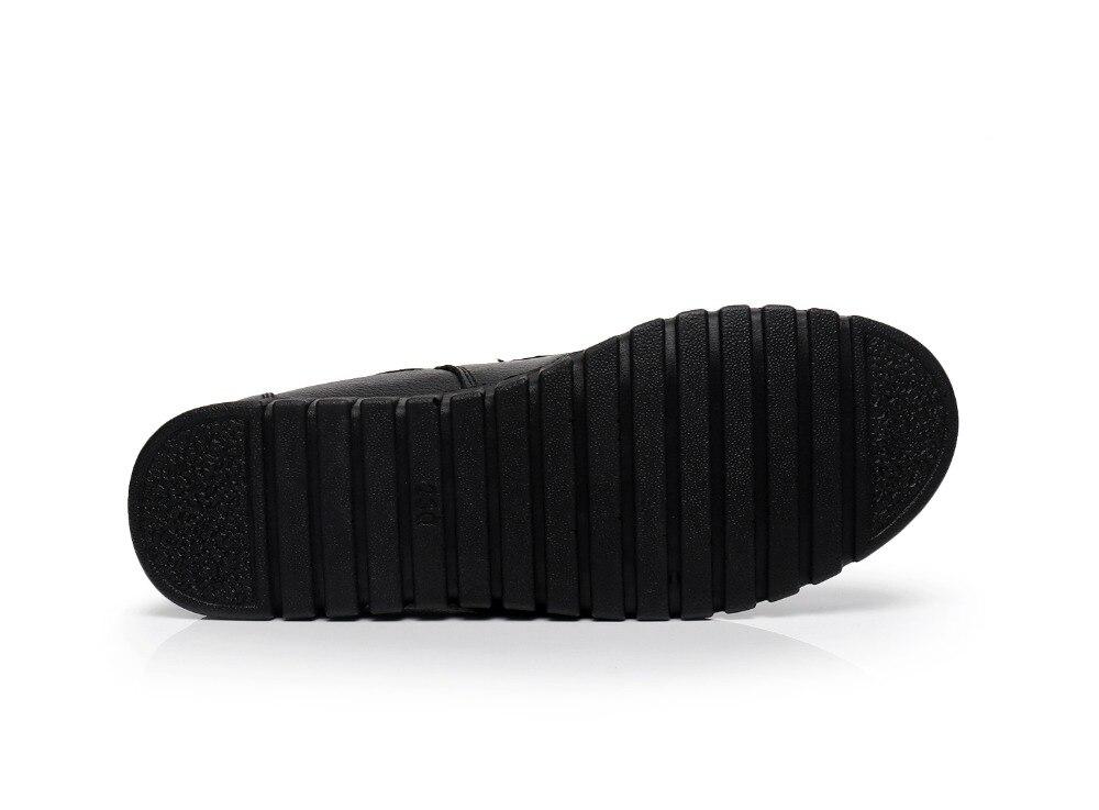 Chaussures orthopédiques hallux valgus.